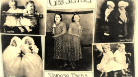 Mary dan Margaret - Si Kembar Siam