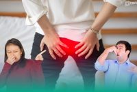 Gambar Kentut Diteliti! Diprediksi Dapat Jadi Viagra Untuk Atasi Impotensi Pria (Sumber: Canva)